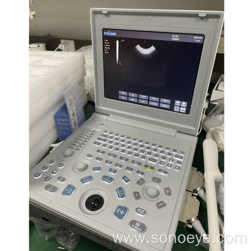 Sonostar SS-6B Ultrasound Machine Better Than SS-7